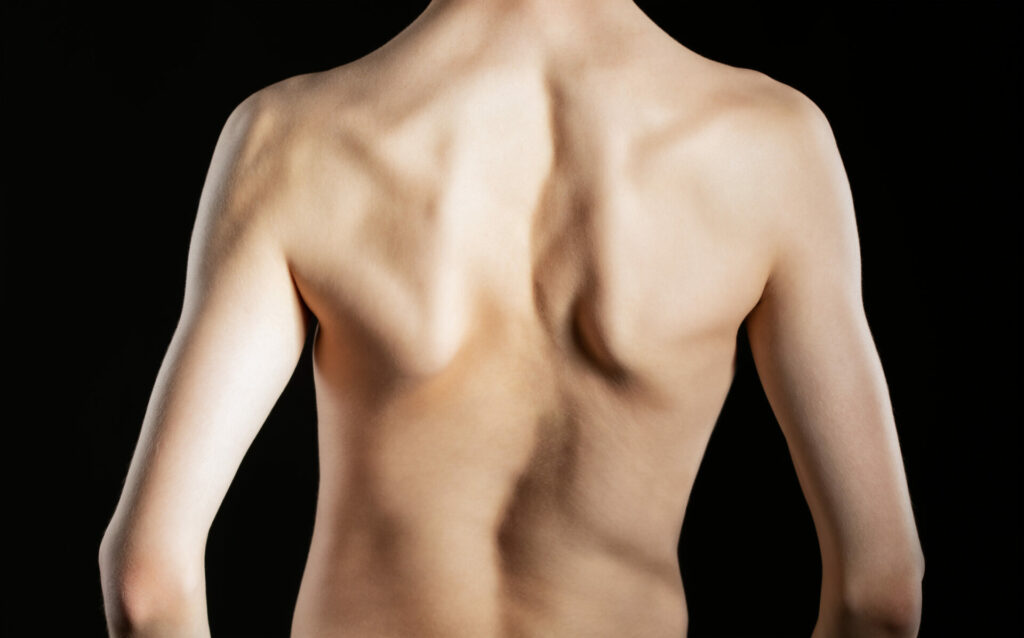 Rear view of male torso showing muscular back and shoulders against black background
